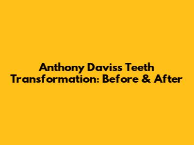 Anthony Davis's Teeth Transformation: Before & After