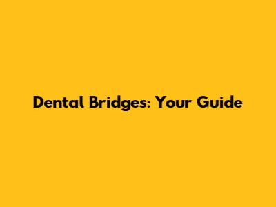 Dental Bridges: Your Guide