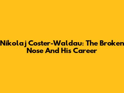 Nikolaj Coster-Waldau: The Broken Nose And His Career