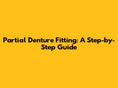 Partial Denture Fitting: A Step-by-Step Guide