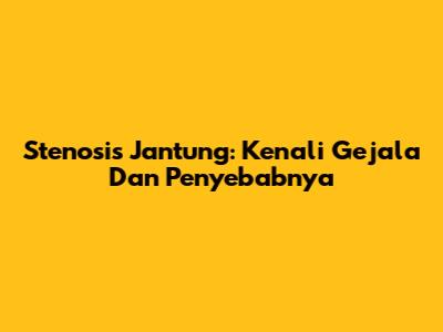 Stenosis Jantung: Kenali Gejala Dan Penyebabnya